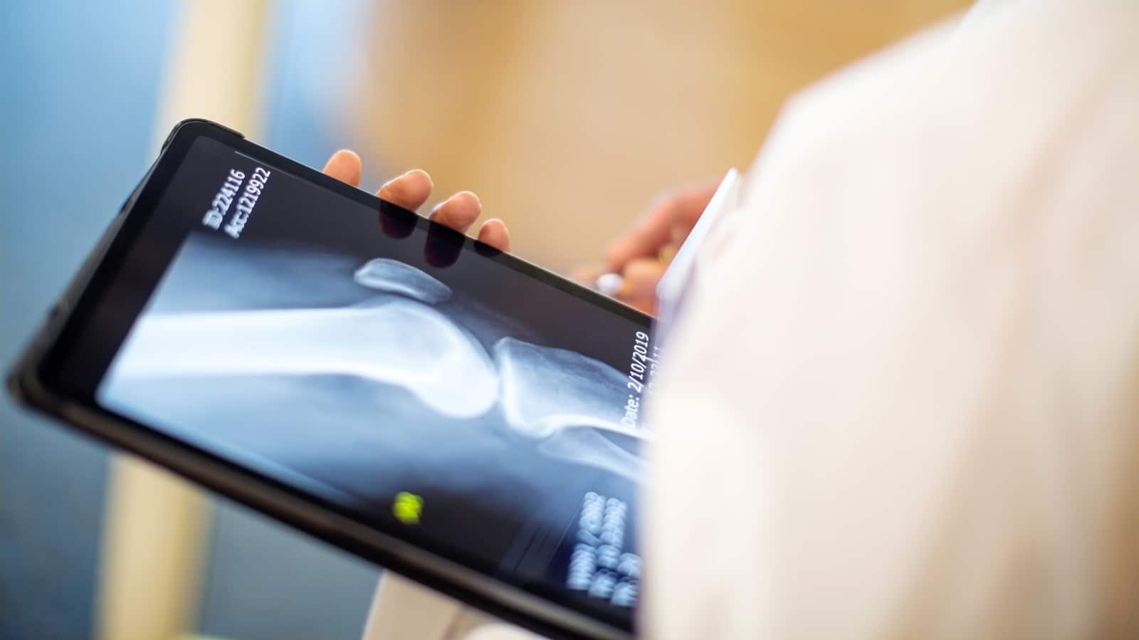 Scientific Breakthrough Identifies Potential Path to Reverse Osteoporosis