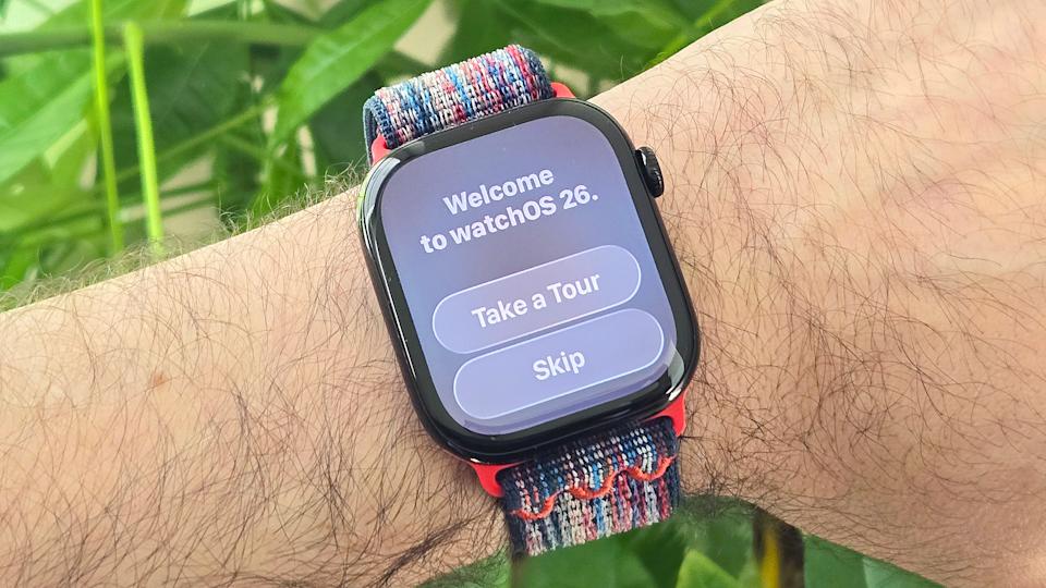 Apple Watch Finally Got Notes in watchOS 26. Here’s How I’m Actually Using It (And One Annoyance)